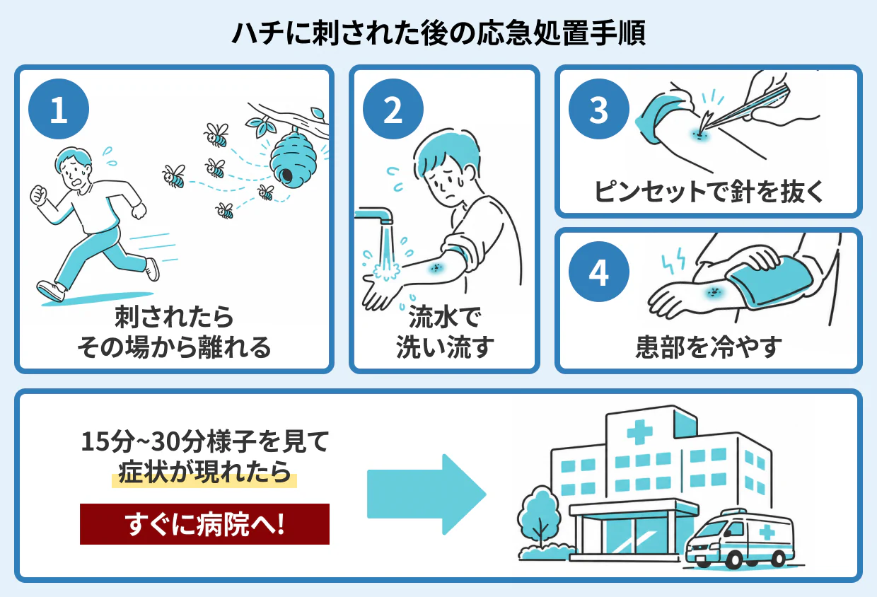 ハチに刺された後の応急処置手順